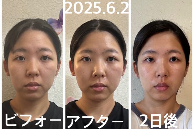 before画像