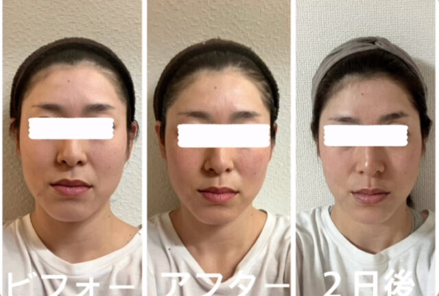 before画像