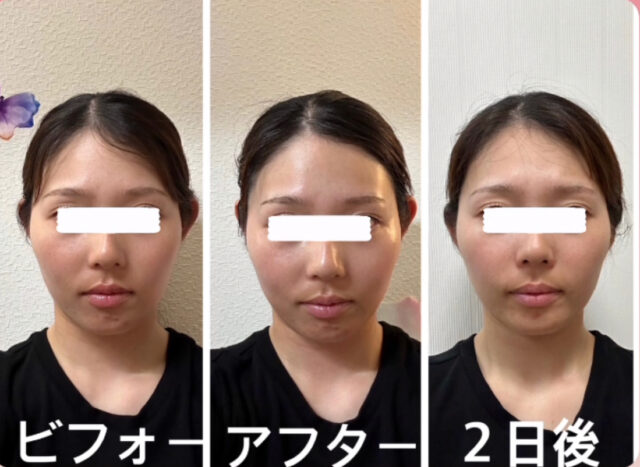 before画像