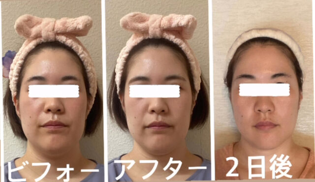 before画像