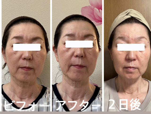 before画像