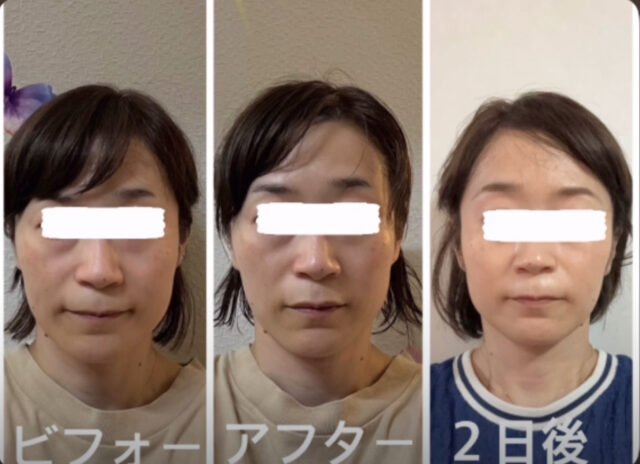 before画像