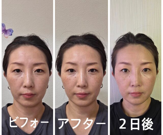 before画像