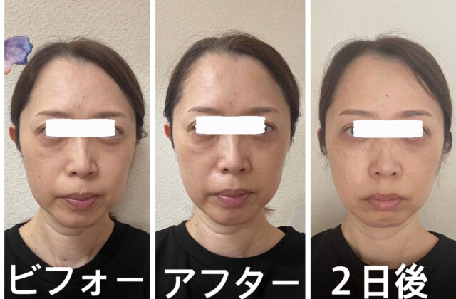 before画像