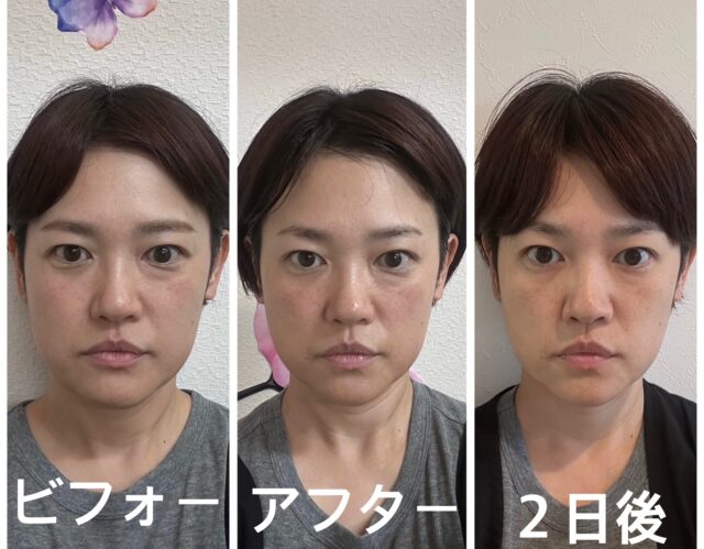 before画像