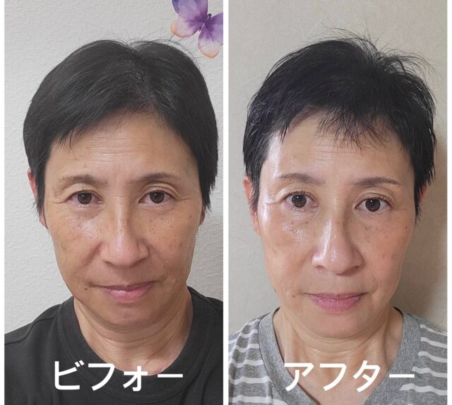 before画像