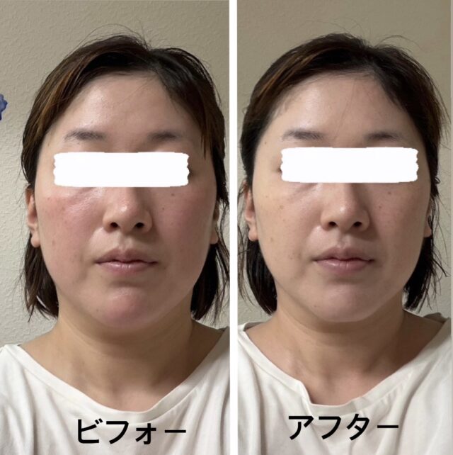 before画像
